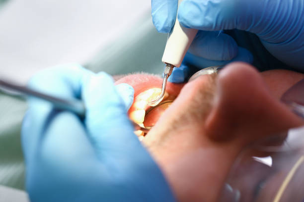 Best Pediatric Emergency Dentist in Kilgore, TX
