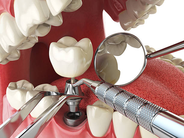 Best Emergency Dental Surgery in Kilgore, TX